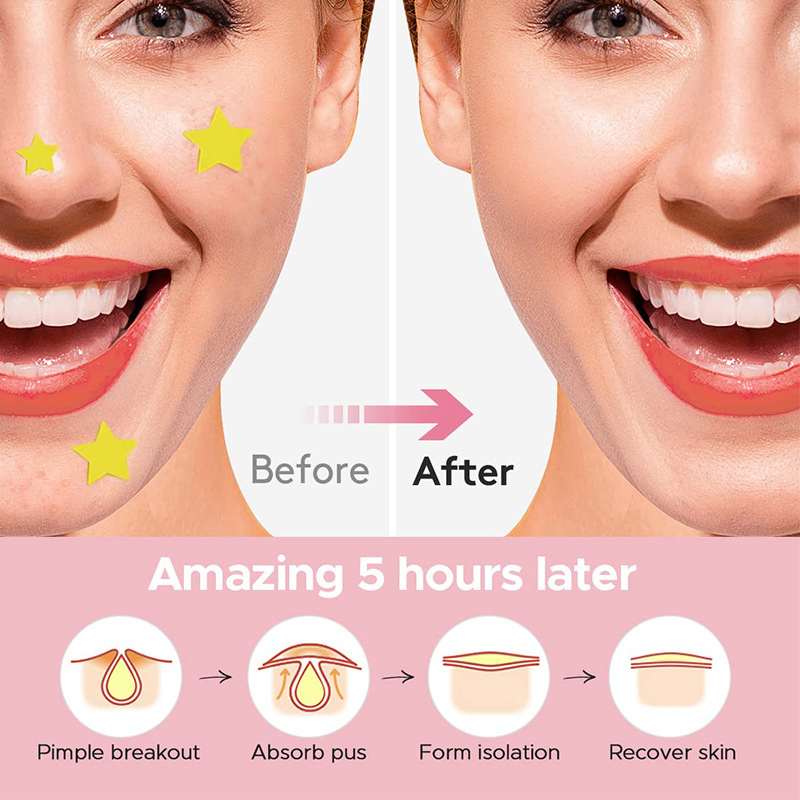 600 PCS/Set Star Pimple Patch  - Beauty Makeup Tools Set ulasan dan harga