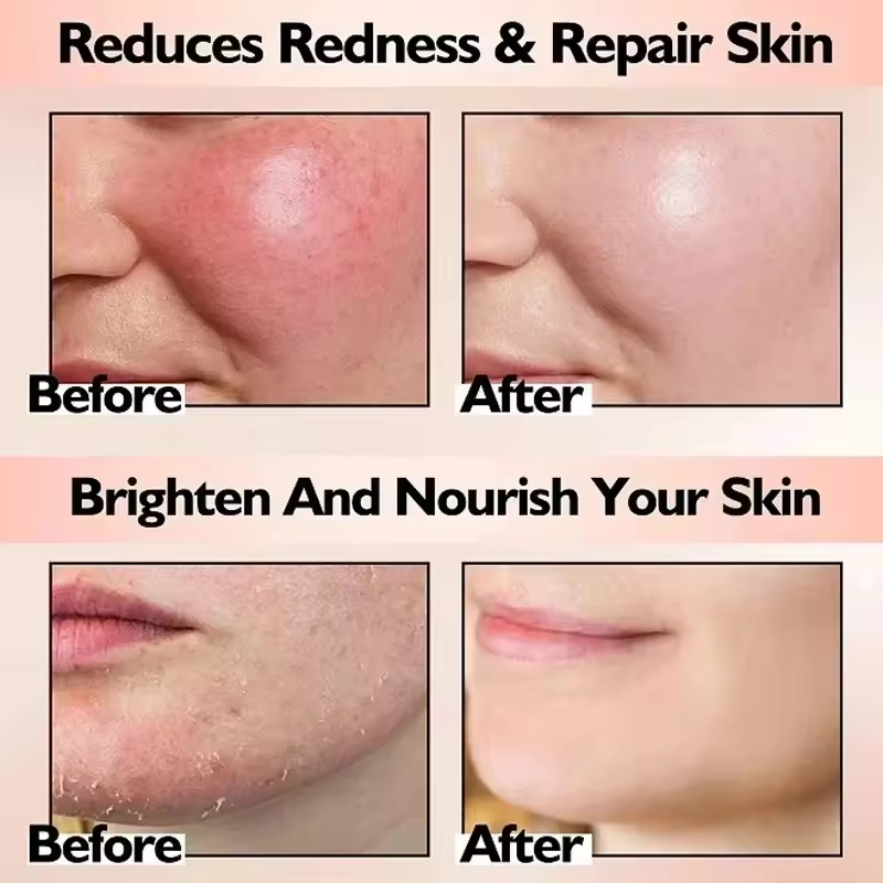 Facial Redness Repair Cream Im - Beauty Makeup Cream ulasan dan harga
