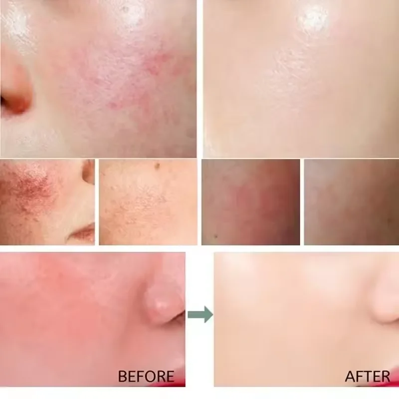 Facial Redness Repair Cream Im - Beauty Makeup Cream ulasan dan harga